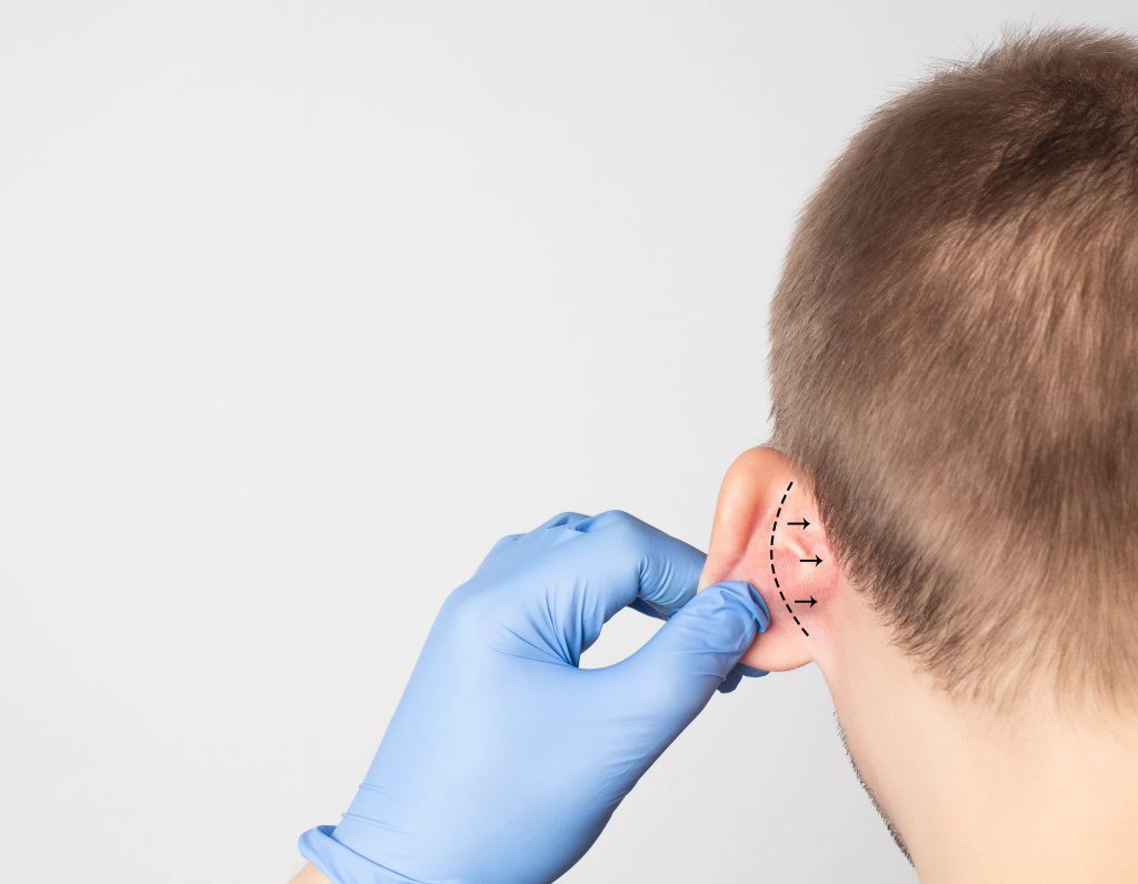 A plastic surgeon doctor examines a male patient s ear for an otoplasty operation. The concept of removing deafness, copy space, procedure