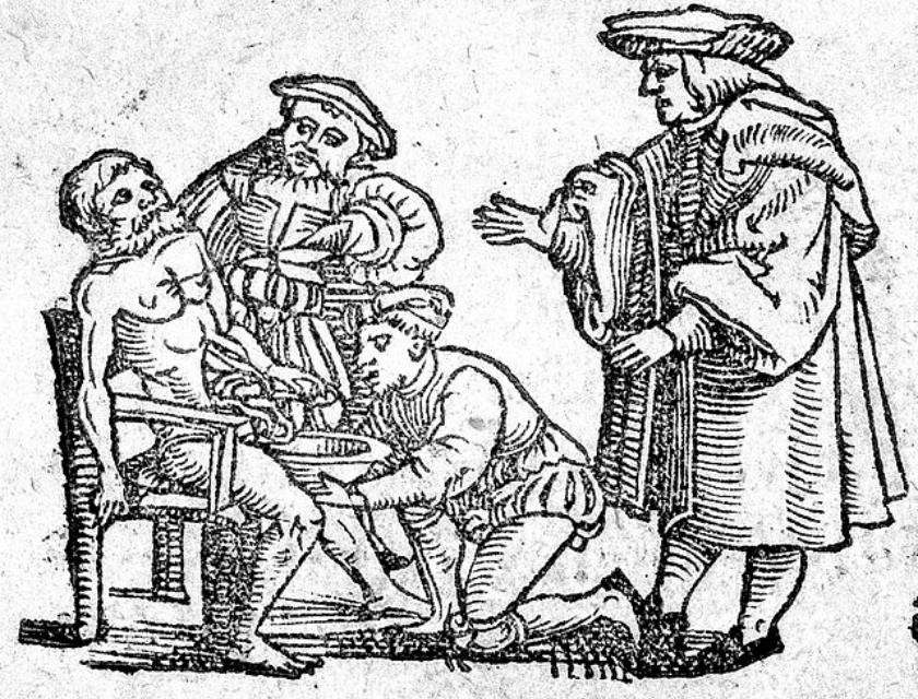 Bloodletting - 20 Historical Facts That Aren't  Facts Afterall